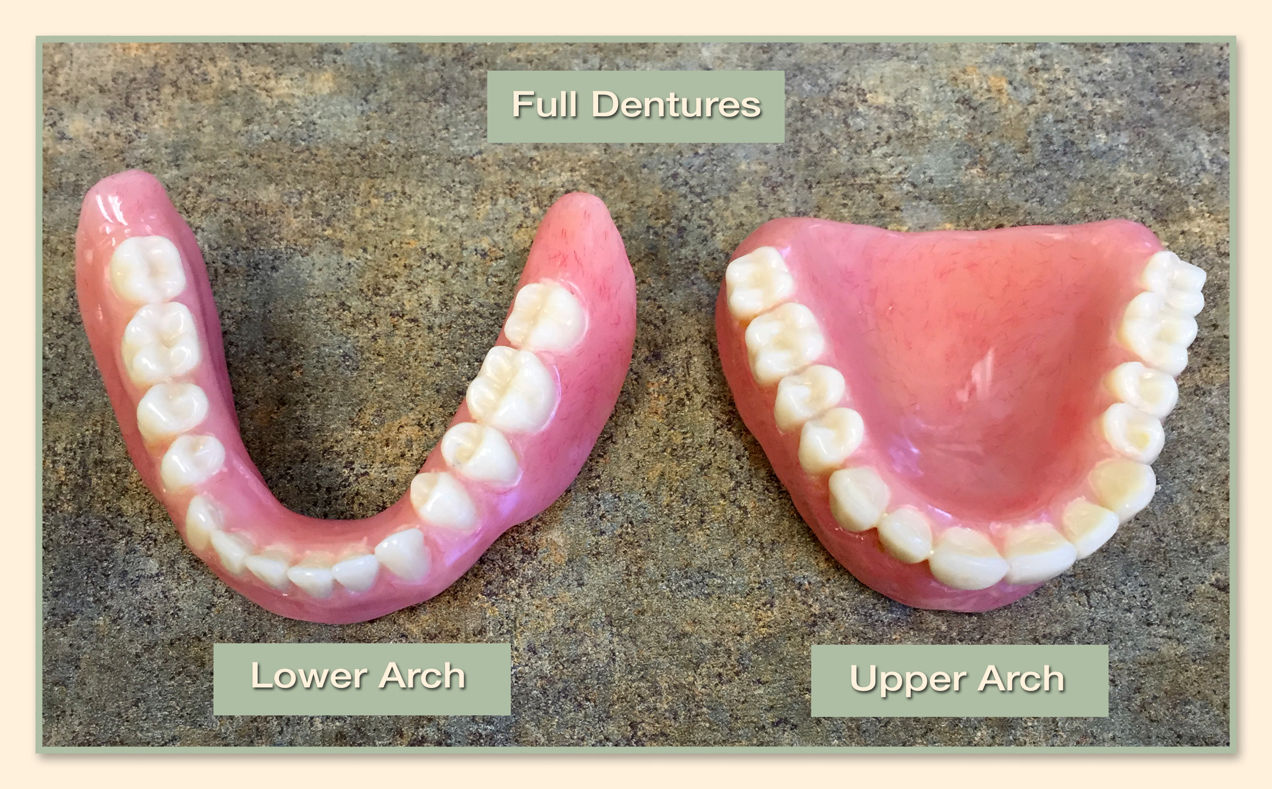 Family Dental Group - Full Dentures